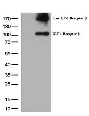 IGF1 Receptor (IGF1R) Mouse mAb