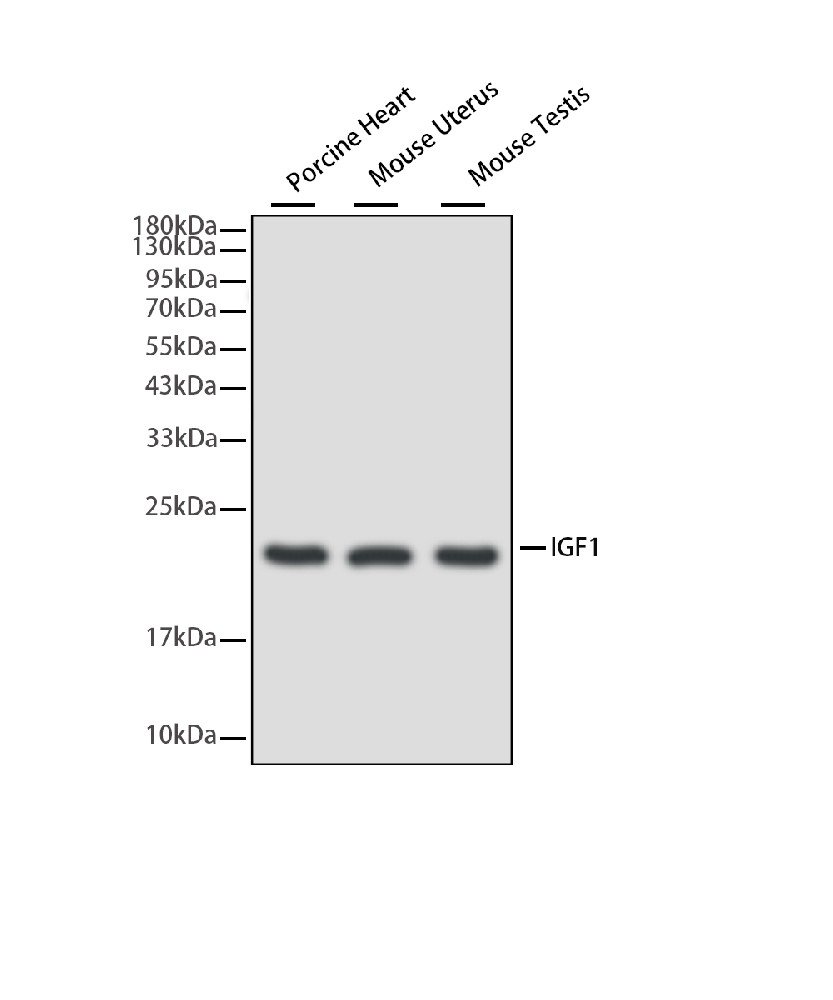 Insulin Like Growth Factor 1 (IGF1) Mouse mAb