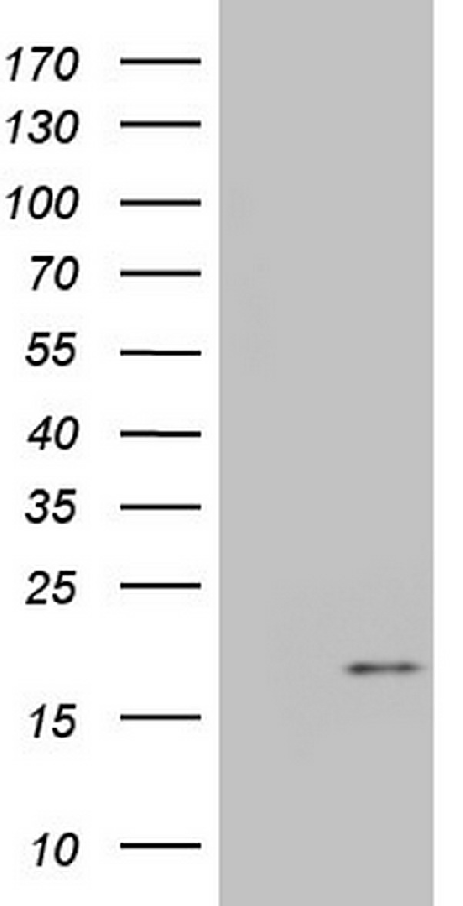 IGF1 Mouse mAb