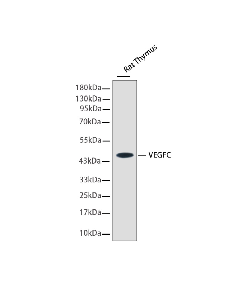Vascular Endothelial Growth Factor C (VEGFC) Mouse mAb