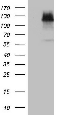 EPAS1 Mouse mAb