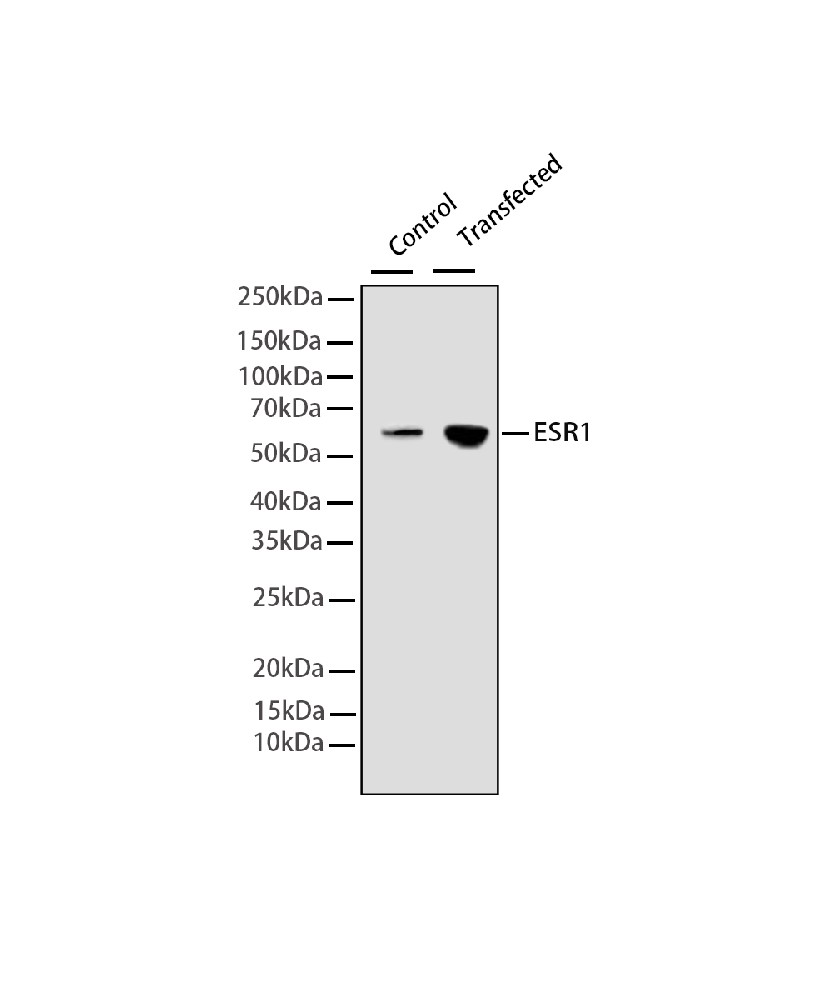 ESR1 Mouse mAb