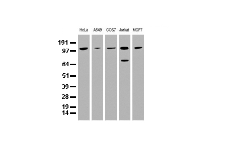 BUB1B Mouse mAb