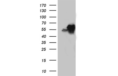 EARS2 Mouse mAb