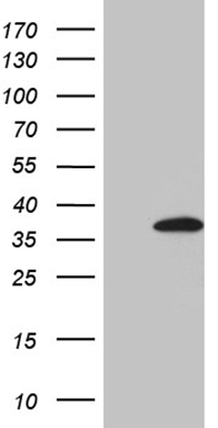 FBXO6 Mouse mAb