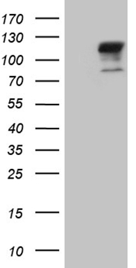 TGFBR3 Mouse mAb