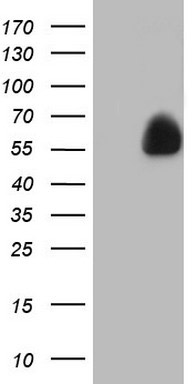 ESRRA Mouse mAb