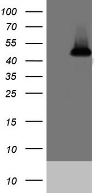 ATP6V1C2 Mouse mAb