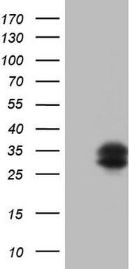 TFPI2 Mouse mAb