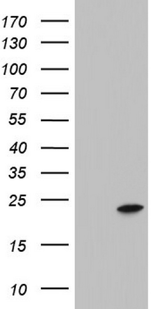 ITGB1BP1 Mouse mAb
