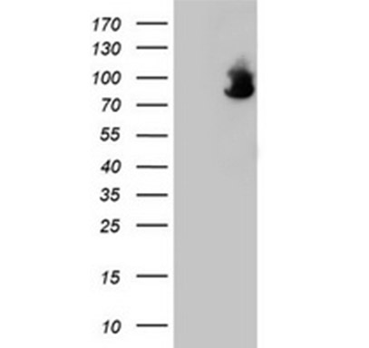 F13A1 (Factor XIIIa) Mouse mAb