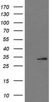 IL1B Mouse mAb