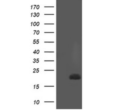 REEP5 Mouse mAb