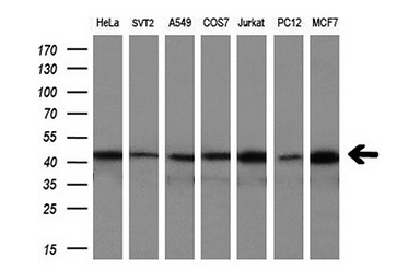 CNDP2 Mouse mAb