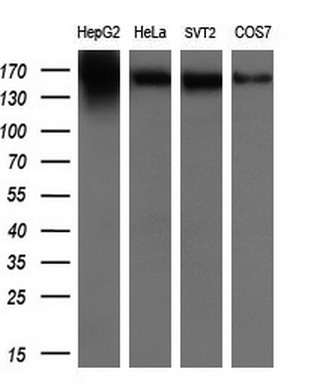ERBB2 Mouse mAb