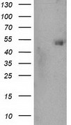 SHPK (CARKL) Mouse mAb