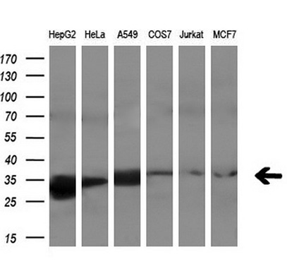 PECR Mouse mAb