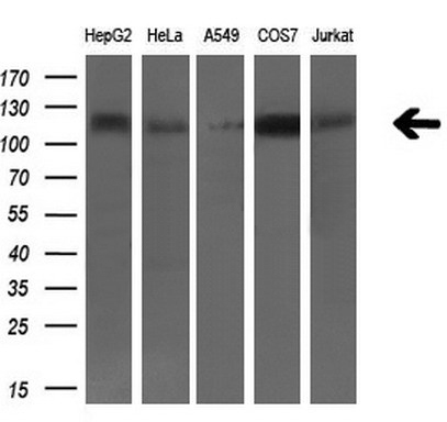 BUB1B (BubR1) Mouse mAb
