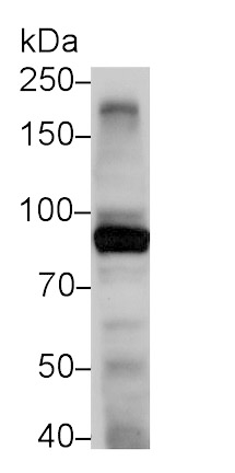 Toll Like Receptor 4 (TLR4) Monoclonal Antibody