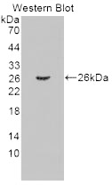 Toll Like Receptor 2 (TLR2) Monoclonal Antibody