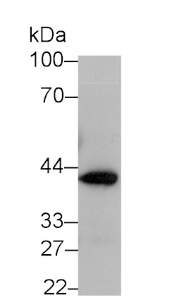 Glutaminyl Peptide Cyclotransferase (QPCT) Monoclonal Antibody