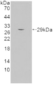 Semaphorin 5B (SEMA5B) Monoclonal Antibody