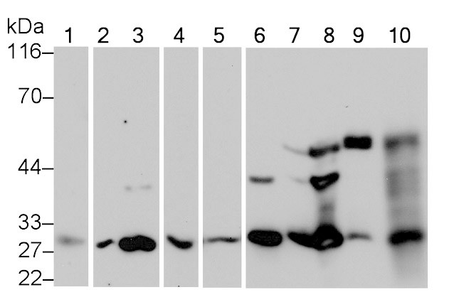 Cathepsin K (CTSK) Monoclonal Antibody