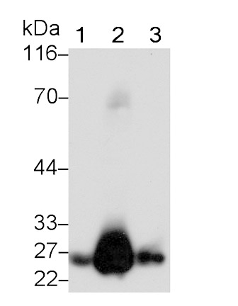 Glutathione S Transferase Alpha 1 (GSTa1) Monoclonal Antibody