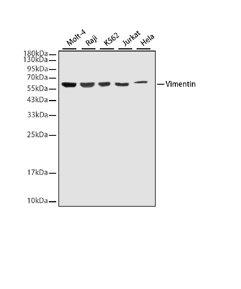 Vimentin (4F8) Mouse mAb