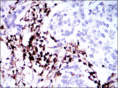 CD45 Mouse mAb