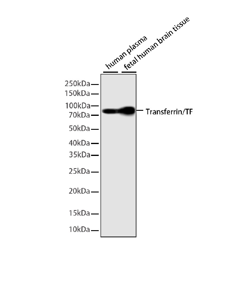 Transferrin Mouse mAb