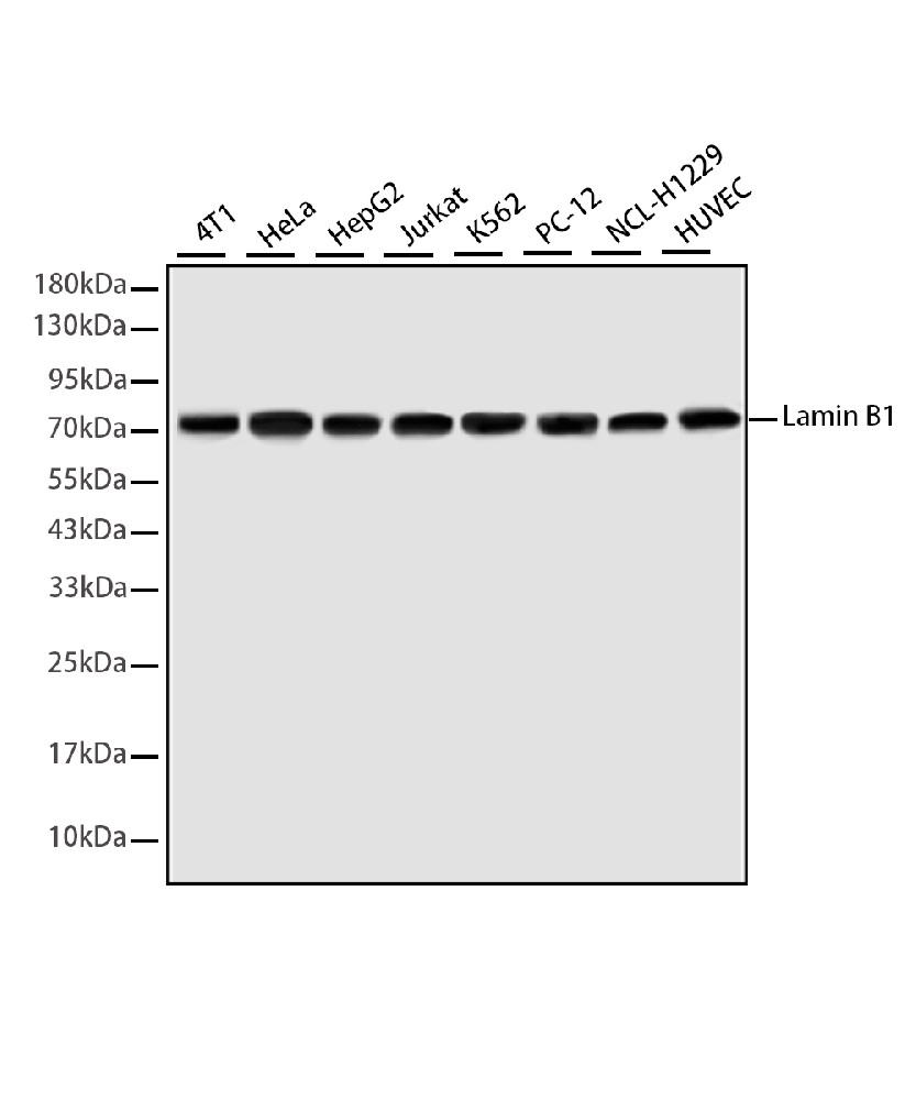lamin B1 Mouse mAb
