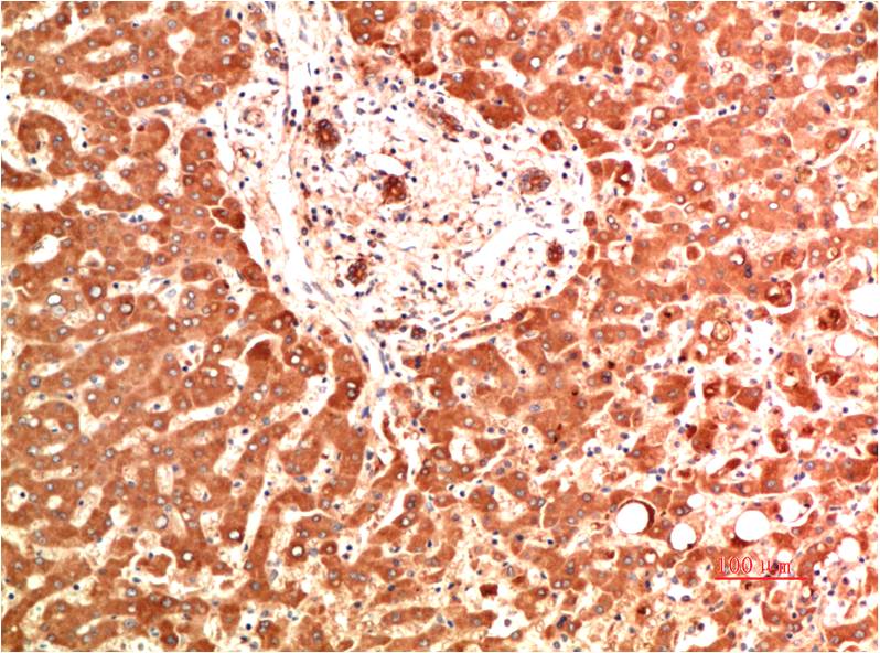 Collagen IV alpha 1 (2G3) Mouse mAb