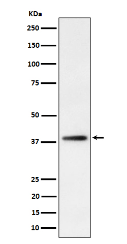 FDPS Rabbit mAb