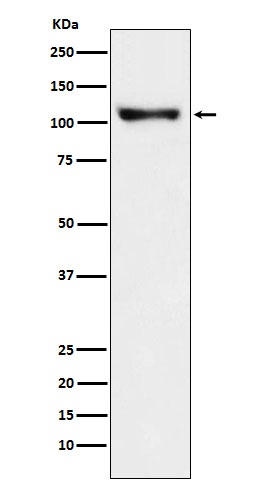 PSD93 Rabbit mAb
