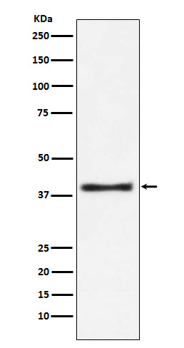 Aspartate Aminotransferase  Rabbit mAb
