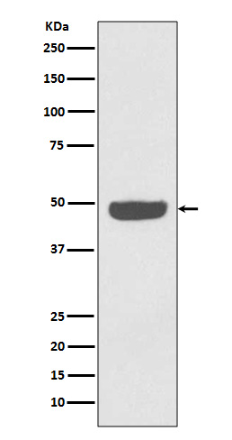 NSE Rabbit mAb