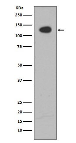 ATP citrate lyase  Rabbit mAb