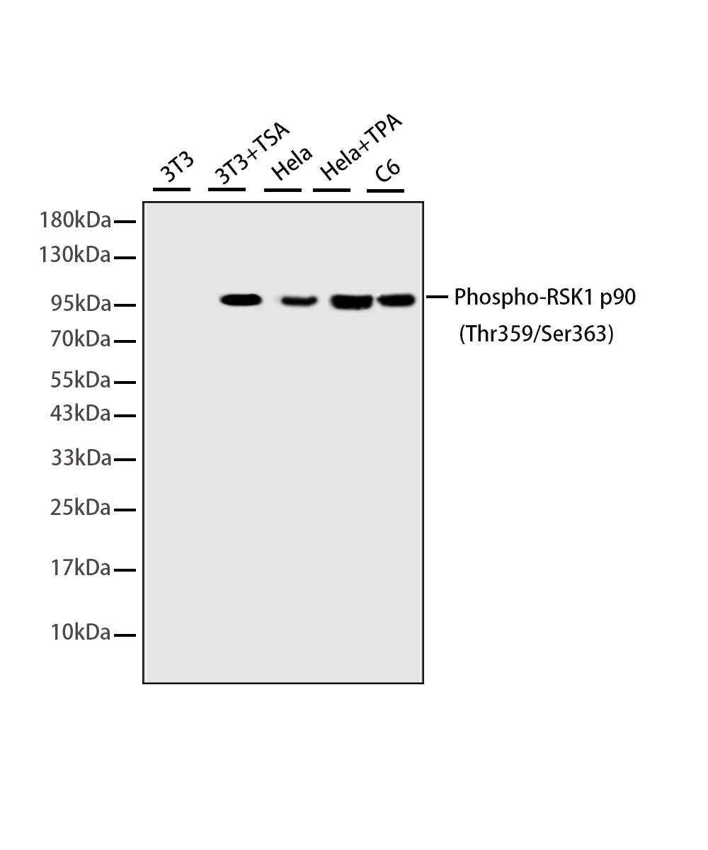 Phospho-RSK1 p90 (Thr359/Ser363) Rabbit mAb