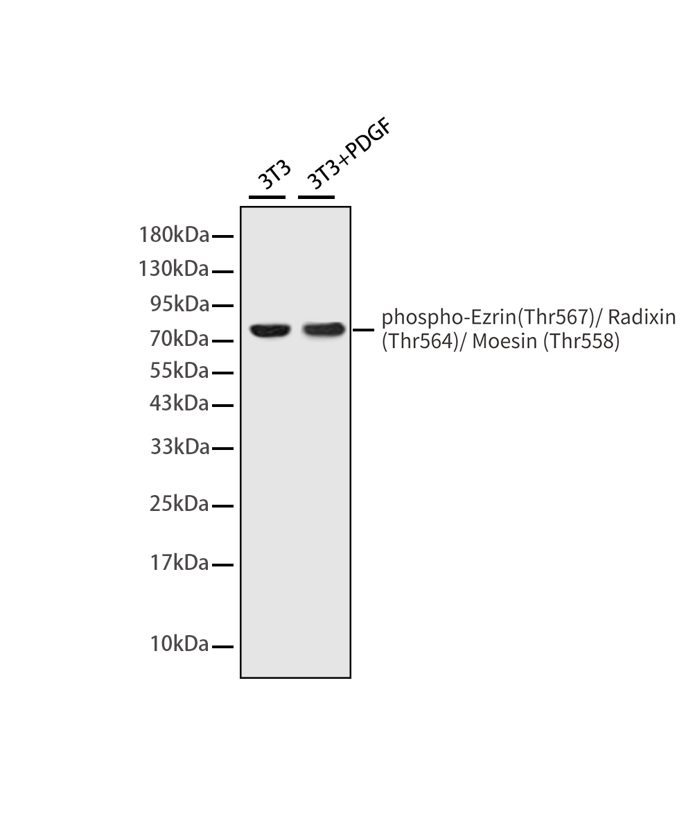 Phospho-Ezrin/Radixin/Moesin (Thr567/Thr564/Thr558) Rabbit mAb