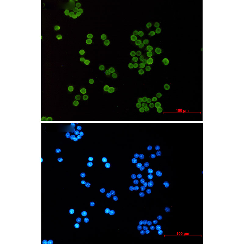 Acetyl-Histone H4 Rabbit mAb