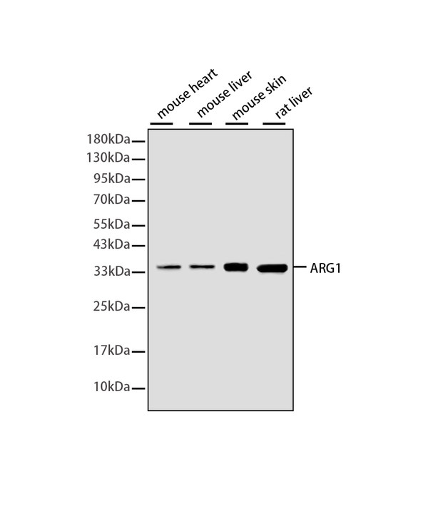 Arginase 1 Rabbit mAb