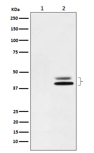 Phospho-ERK1 (T202) + ERK2 (T185) Rabbit mAb