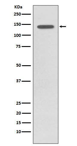 Phospho-TrkB (Y817) Rabbit mAb
