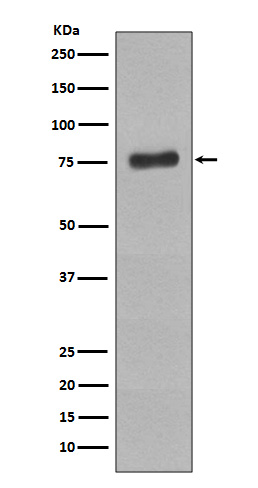 Phospho-BTK (Y223) Rabbit mAb