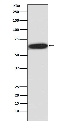 Phospho-S6K1 (T421 + S424) Rabbit mAb