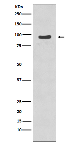 Phospho-p95/NBS1 (S343)  Rabbit mAb
