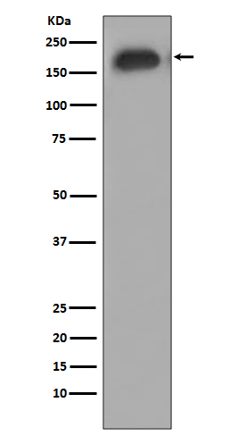 Phospho-EGFR (Y1092) Rabbit mAb