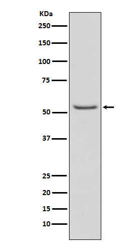 Phospho-Smad3 (S423 + S425) Rabbit mAb