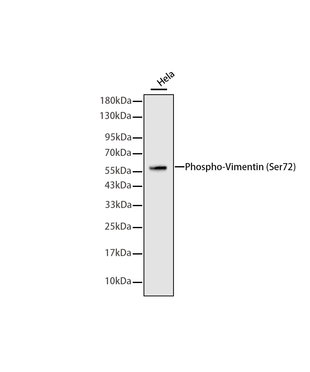Phospho-Vimentin (S72) Rabbit mAb